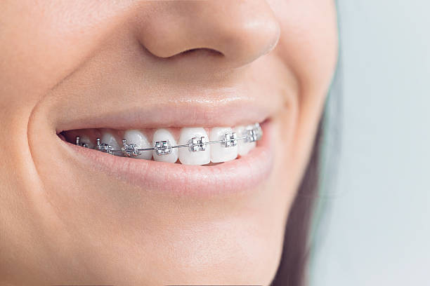 Best Dental Fillings (Composite and Amalgam)  in Westville, IN